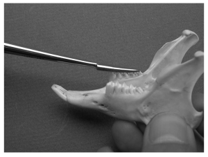 A hand file is used to smooth the premolar teeth