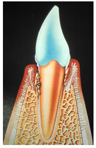 Diagram of formation of a periodontal pocket. Virbac poster on periodontal disease