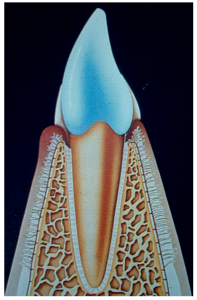 Diagram of tooth and sub-gingival plaque - Virbac poster on periodontal disease