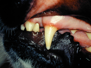 Enamel hypomineralisation, showing a lack of enamel formation from the gingival margin to the cusp