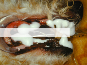 Fluoride foam placed on the teeth after polishing