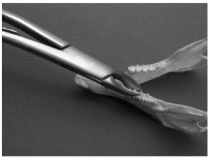 Molar cutters used to trim lingual hooks and spurs from the mandibular premolar teeth
