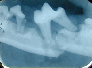 Pathological fracture of mandible following a dog fight. Note the existing periodontal disease and horizontal alveolar bone loss from the fourth premolar to the 1st molar teeth