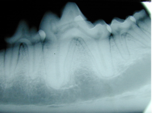 Radiograph of the mandibular 1st molar tooth showing normal anatomy