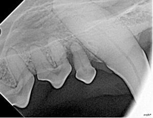 Radiograph of vertical alveolar bone loss surrounding the root of the maxillary right first premolar tooth (105) in a dog. Note radiolucency of bone