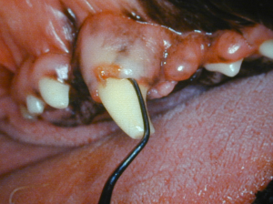 The introduction of a curette sub-gingivally